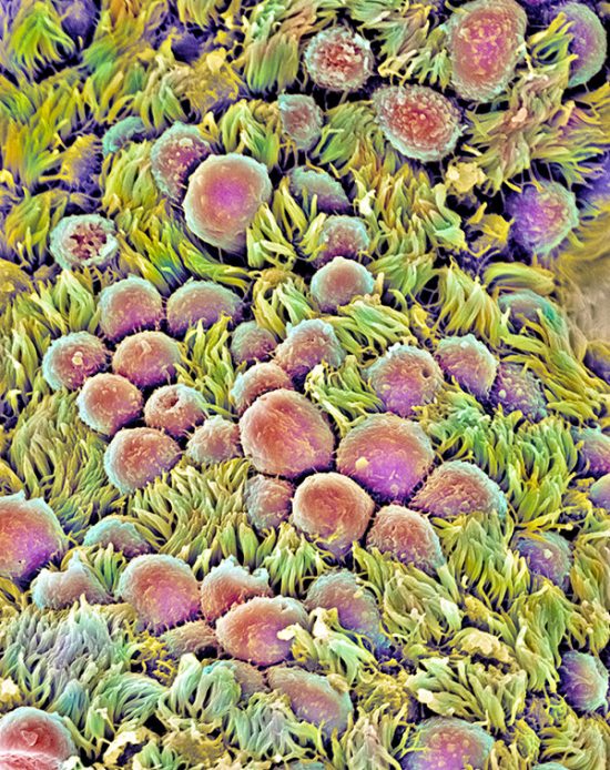 Fallopian tube, Coloured scanning electronmicrograph (SEM) of the epithelial lining of a Fallopian tube (oviduct). B6E02K Fallopian tube, Coloured scanning electronmicrograph (SEM) of the epithelial lining of a Fallopian tube (oviduct).